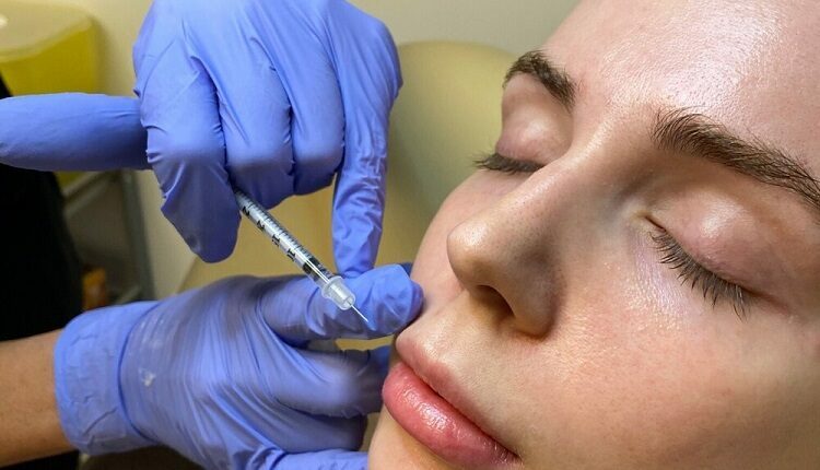 lip fillers Vancouver